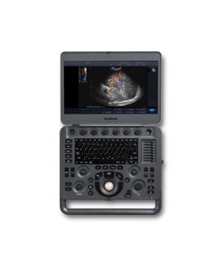 sonoscape x3 ultrasound machine