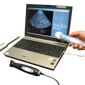 Shop for USB from National Ultrasound