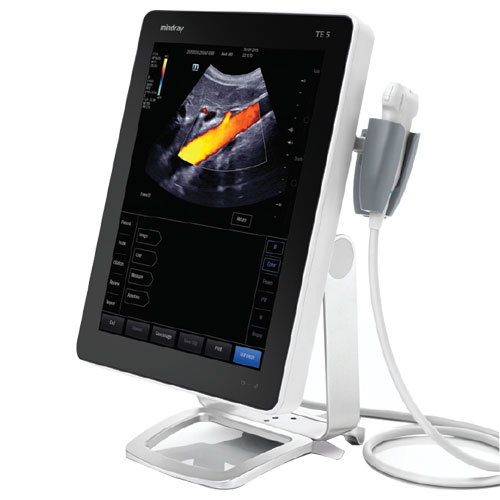 Afsky forberede via Portable Ultrasound Machines for Small Practices | National Ultrasound