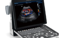 5 Best Ultrasound Machines For Dogs - National Ultrasound